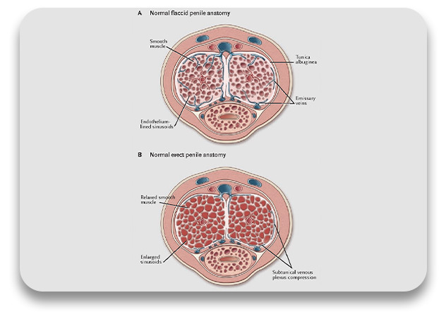 Erectile dysfunction